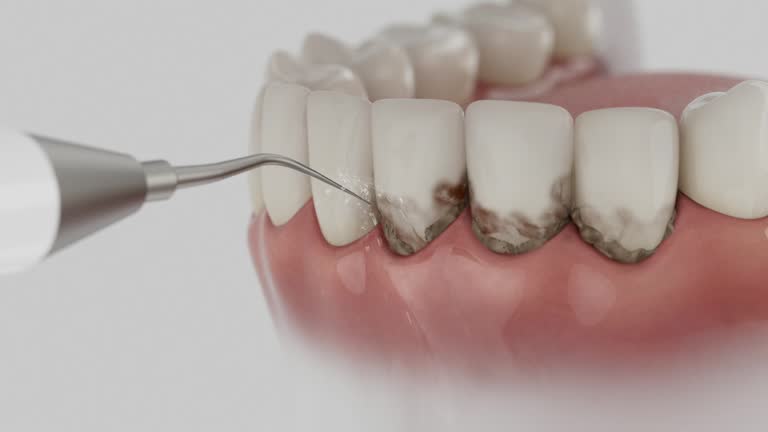 Trusted Teeth Cleaning And Checkup service in Maineville, OH - Dentist Open Now